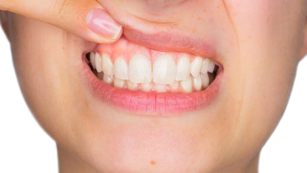 Philips Clean White Teeth i